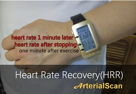 ArterialScan，动脉扫描也时尚化了，戴上就能测！